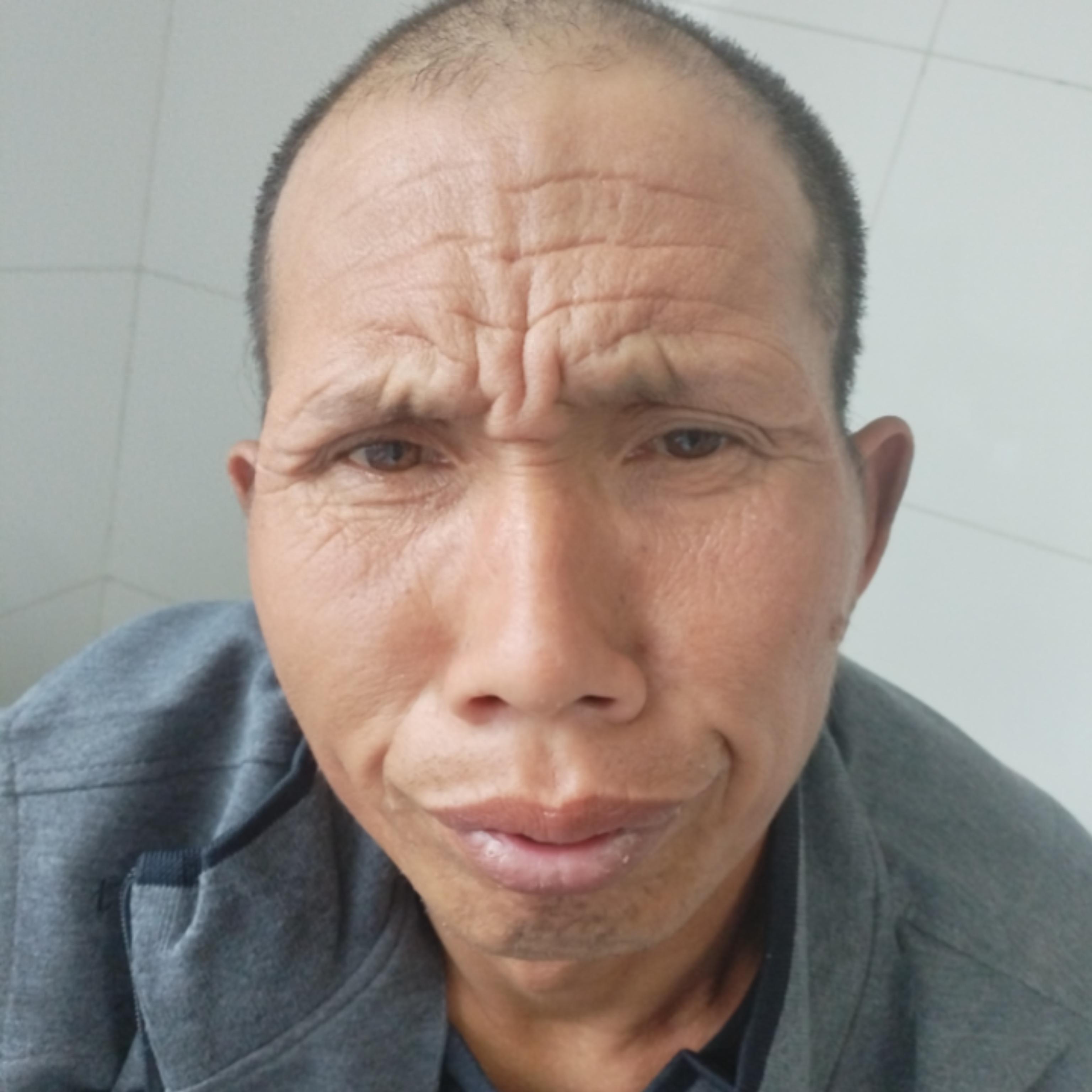 走失者照片 宿州市寻亲：五旬男子被救助，高1米...