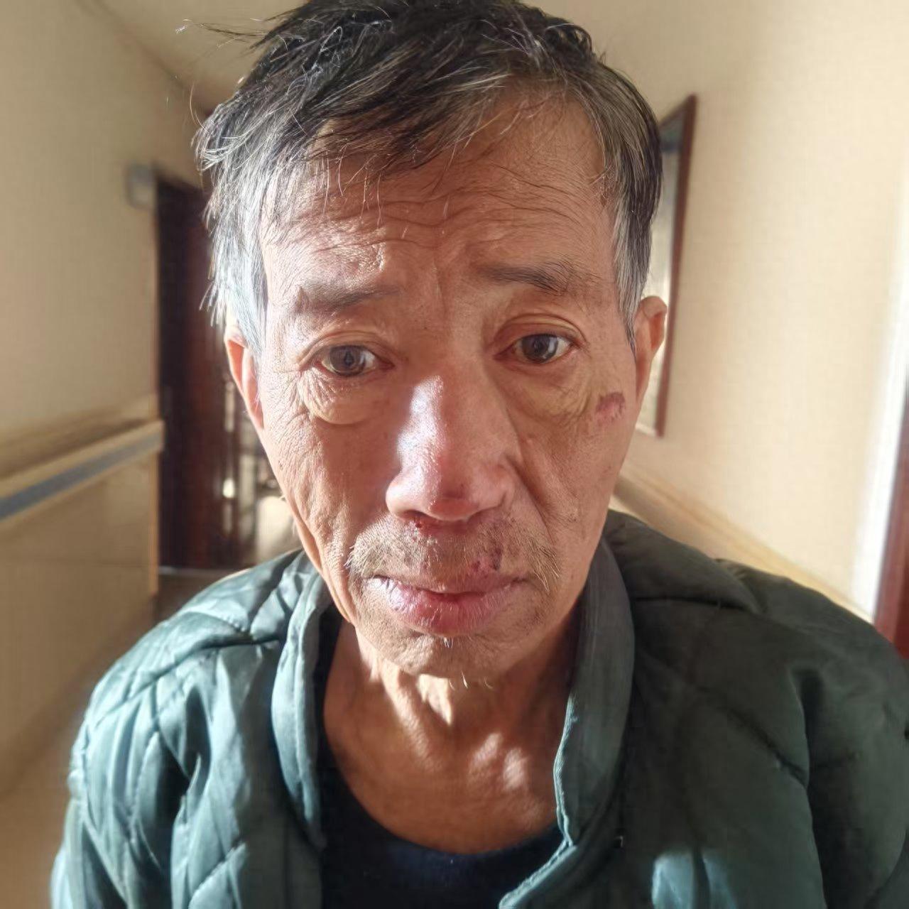 走失者照片 大同市寻亲:五旬男子被救助,自述叫...