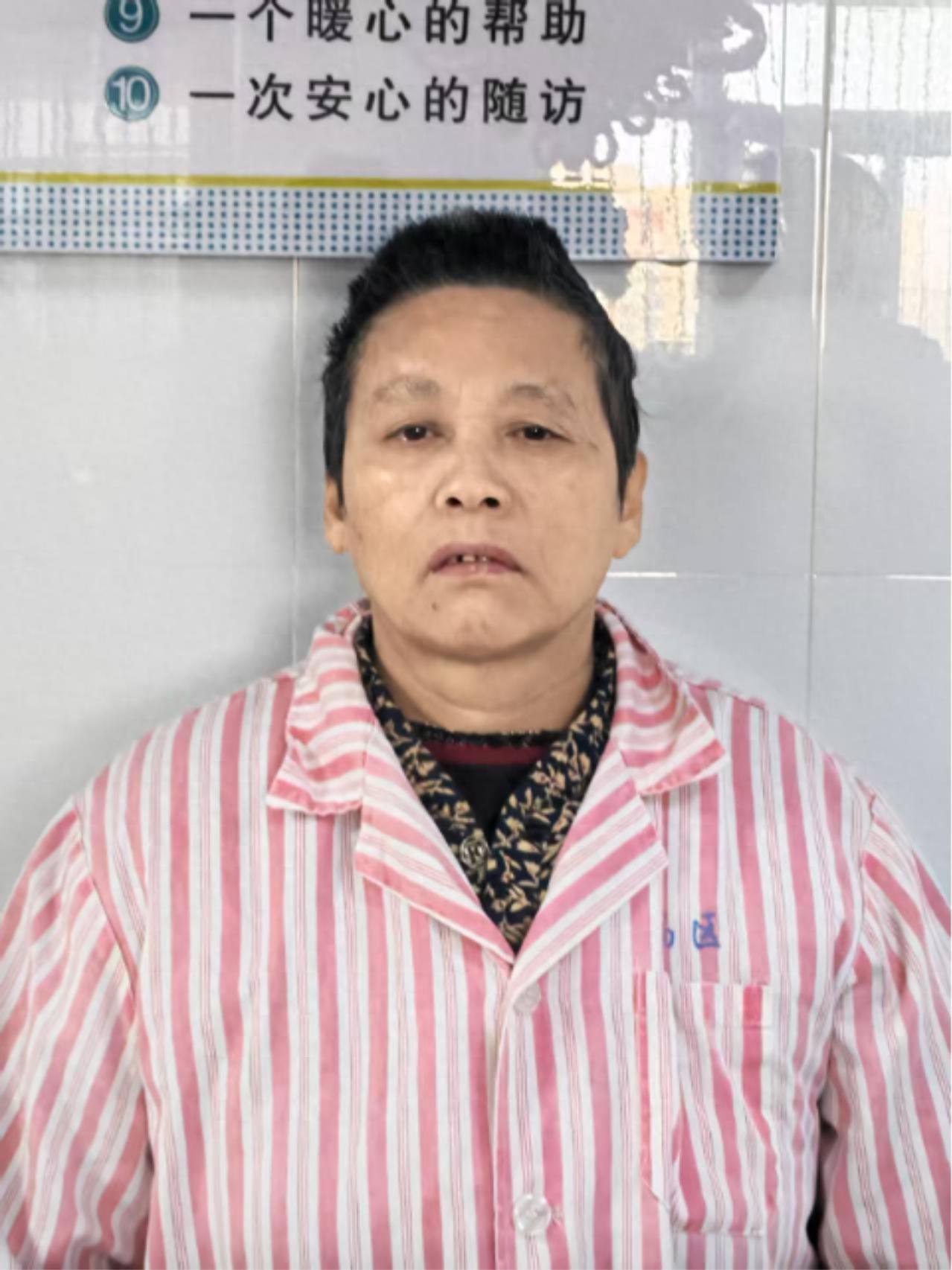 走失者照片 安庆市寻亲：五旬女子被救助，疑似精...