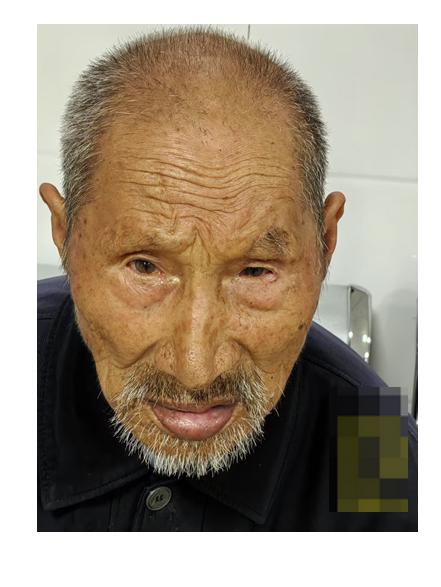 走失者照片 宿州市寻亲：七旬老人被救助，高1米...