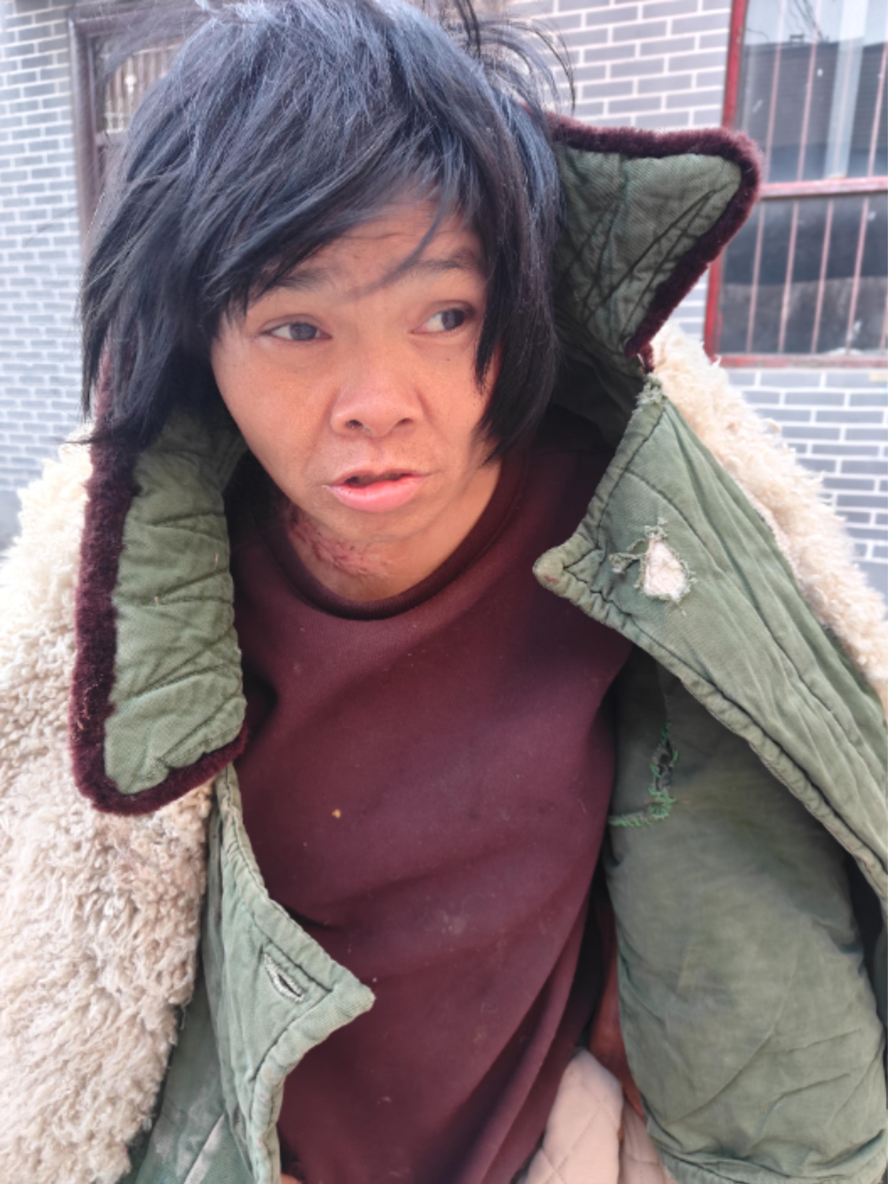 走失者照片 邯郸市寻亲：五旬女子被救助，疑似精...