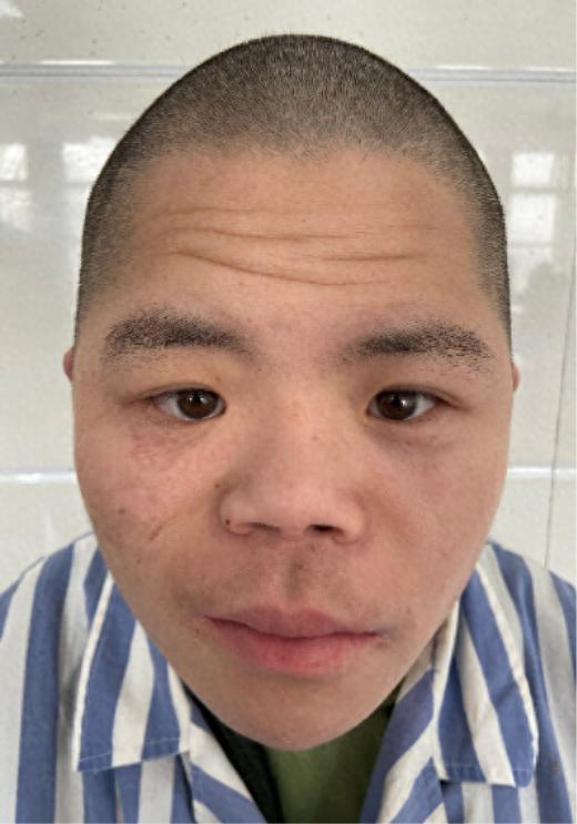 走失者照片 北京市寻亲：青年男子被救助，疑患智...