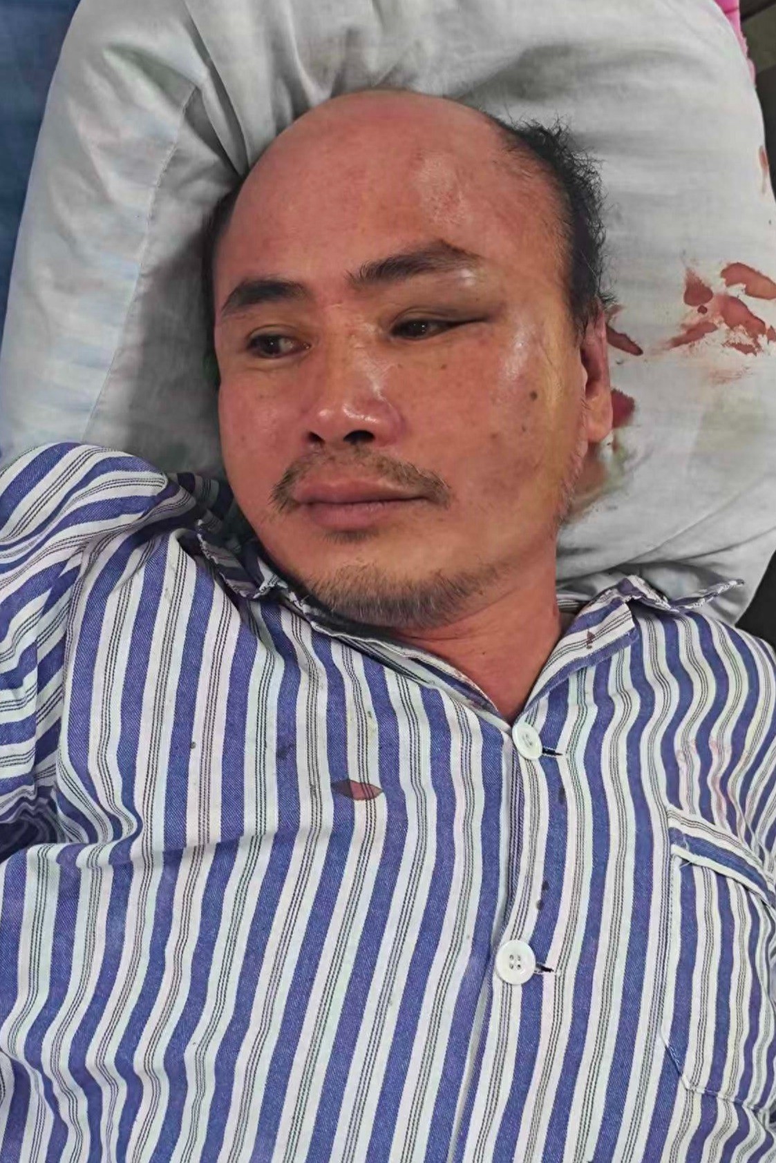 走失者照片 海口市寻亲：中年男子被救助，自述叫...