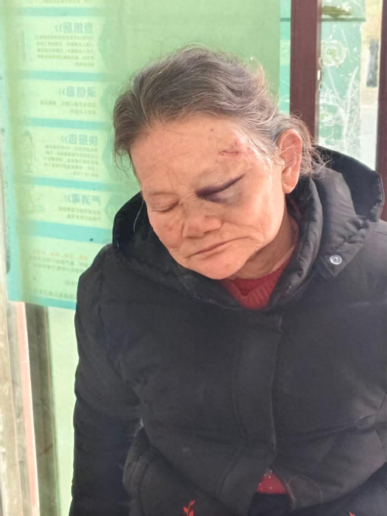 走失者照片 巴中市寻人：七旬老太走失，患小脑萎...