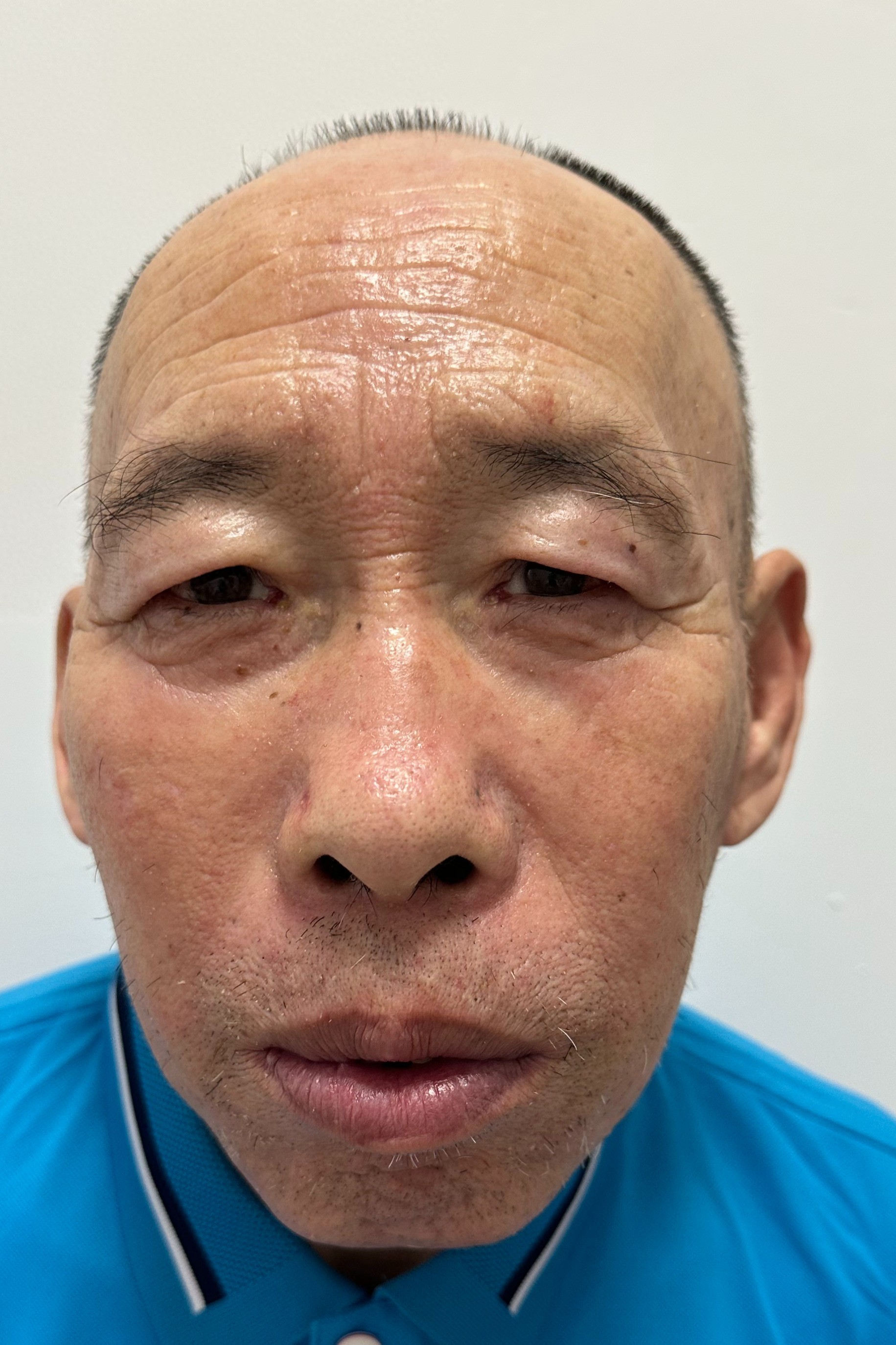 走失者照片 秦皇岛市寻亲：六旬老人被救助，自述...