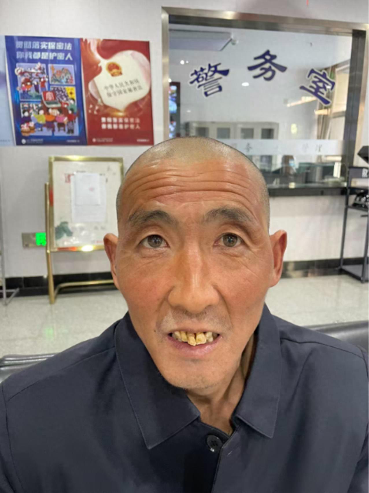 走失者照片 晋中市寻亲：六旬老人被救助，左手食...