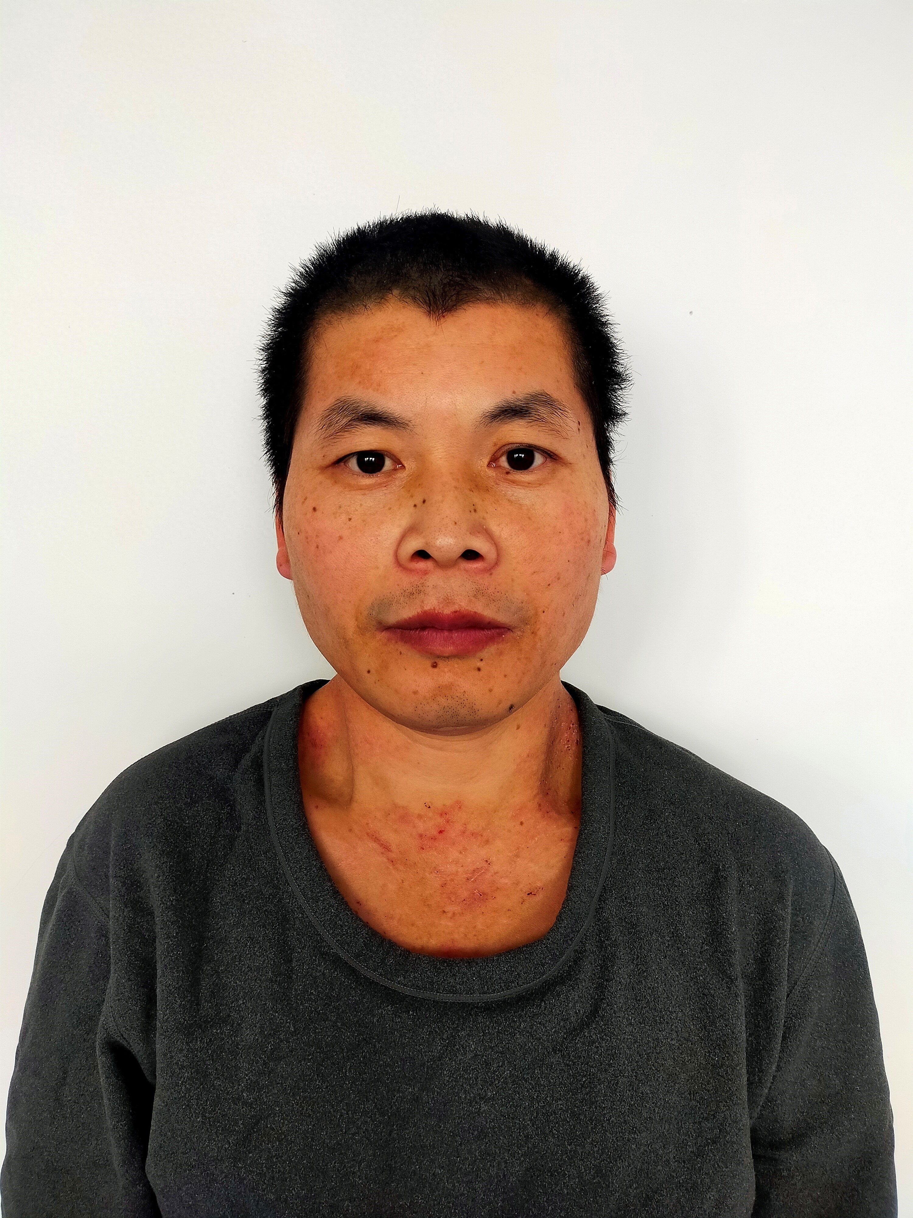 走失者照片 北京市寻亲：青年男子被救助，高1米...