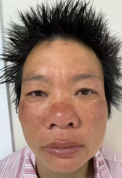 走失者照片 北京市寻亲：中年女子被救助，系聋哑...