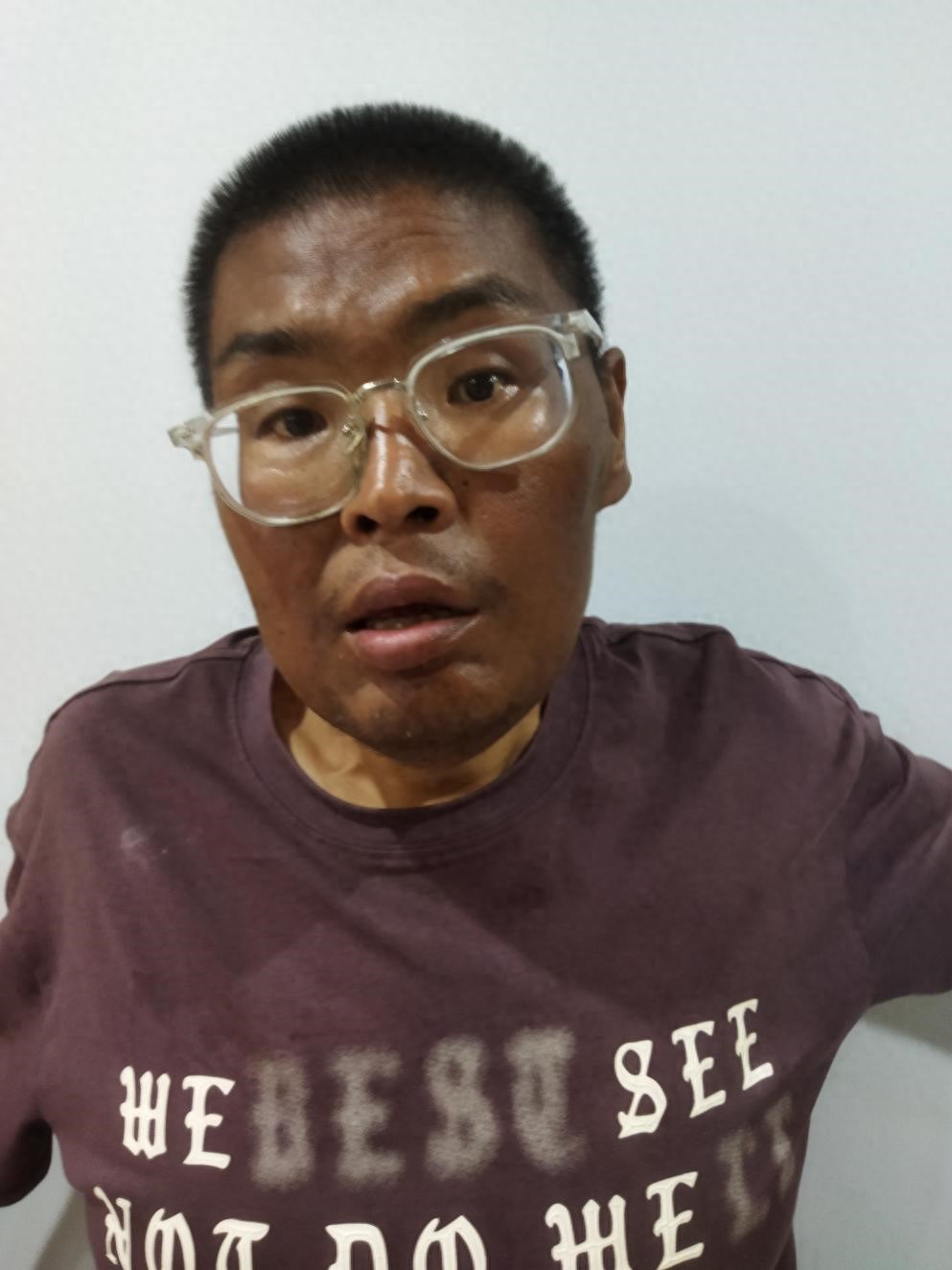 走失者照片 惠州市寻亲：中年男子被救助，面色发...