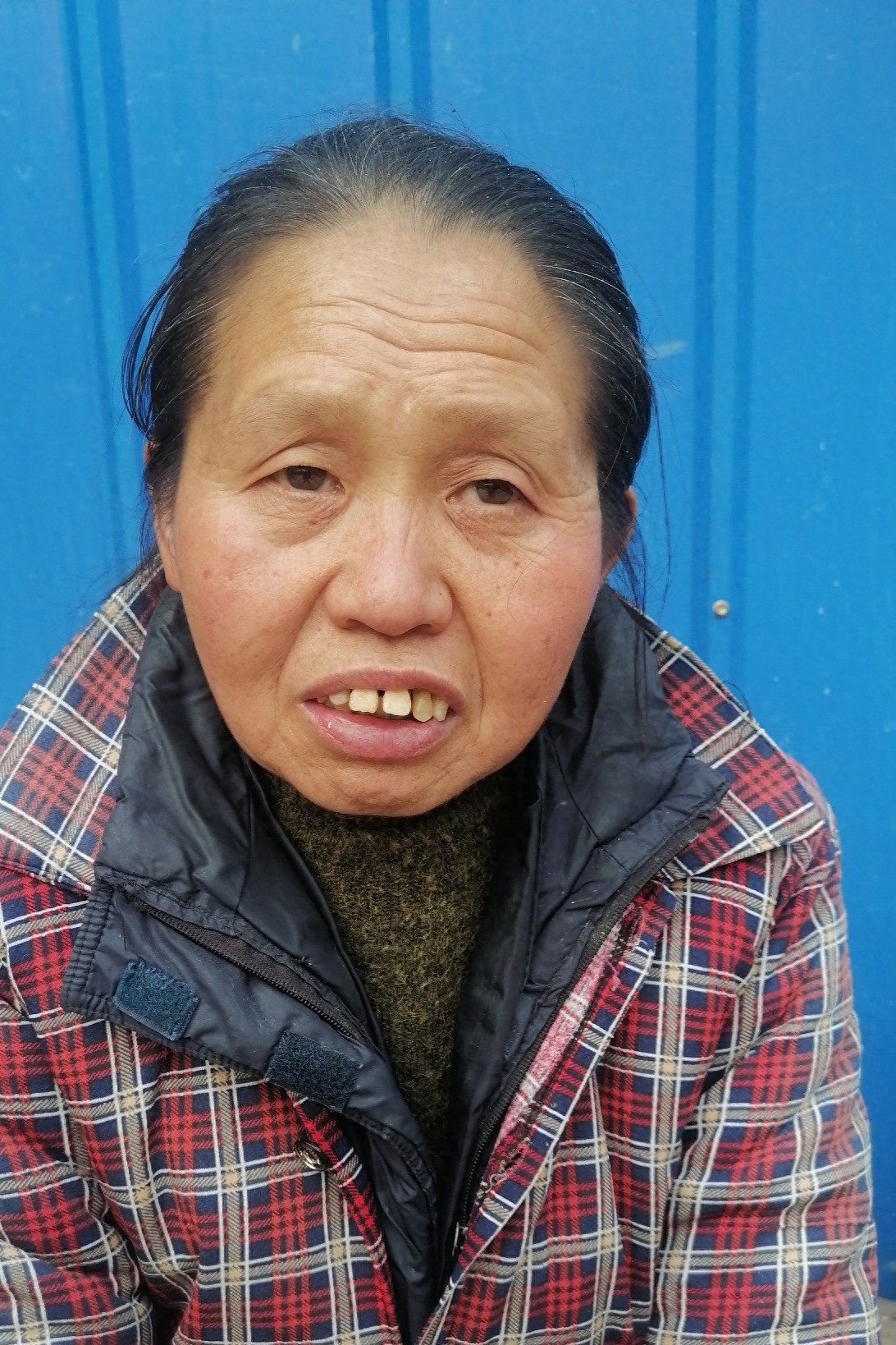 走失者照片 重庆市寻亲：五旬女子被救助，穿花棉...