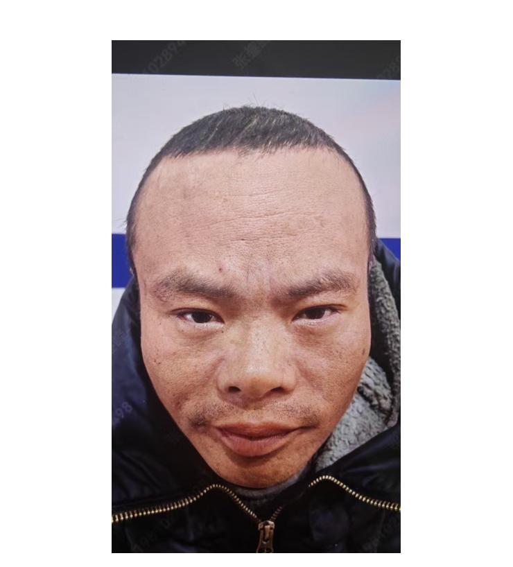 走失者照片 北京市寻亲：青年男子被救助，自述叫...