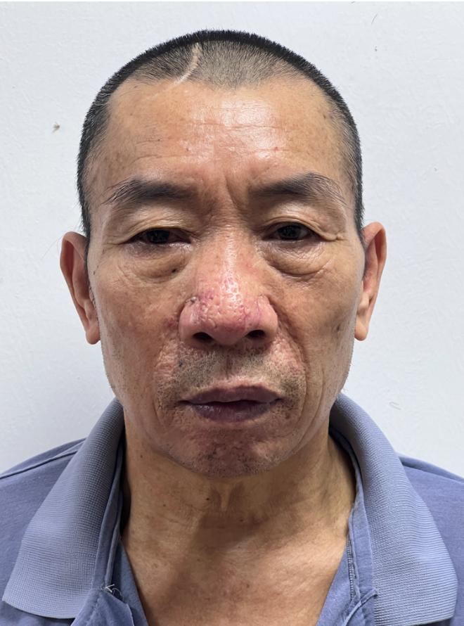 走失者照片 汕头市寻亲：五旬男子被救助多年，系...