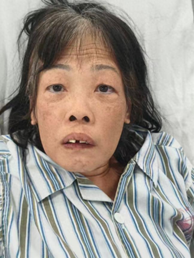 走失者照片 江门市寻亲：六旬老太被救助，经查疑...