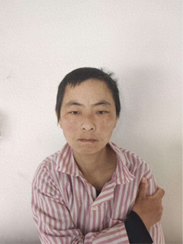 走失者照片 大同市寻亲：中年女子被救助，疑似精...