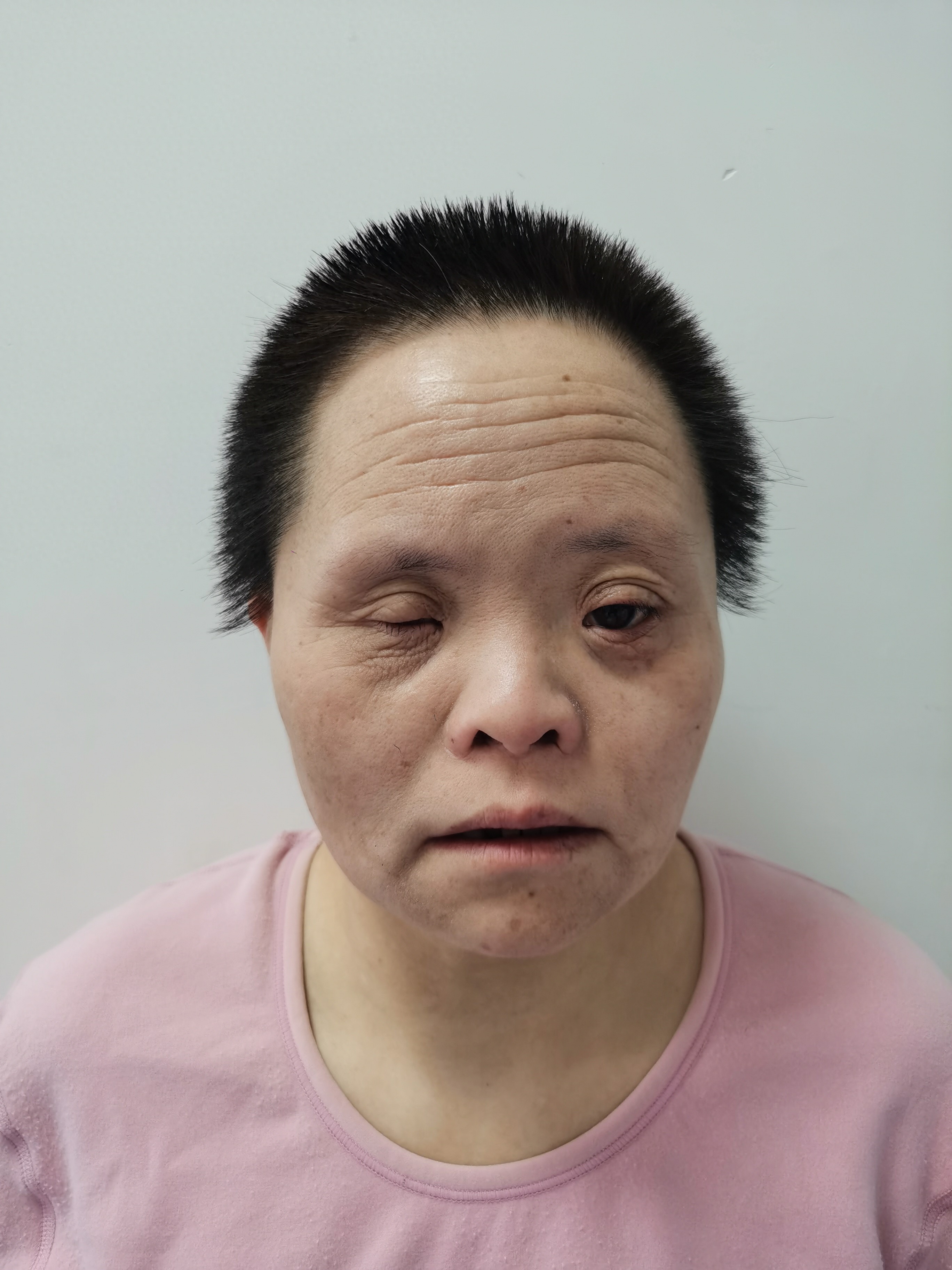走失者照片 北京市寻亲：中年女子被救助，牙齿缺...
