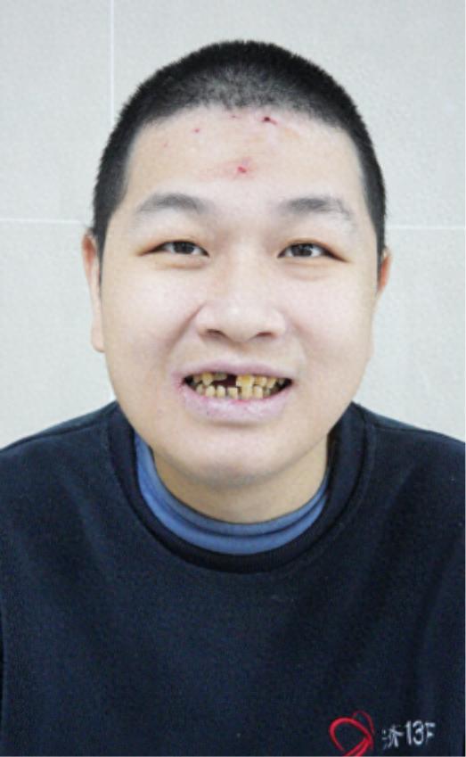 走失者照片 厦门市寻亲：青年男子被救助多年，自...