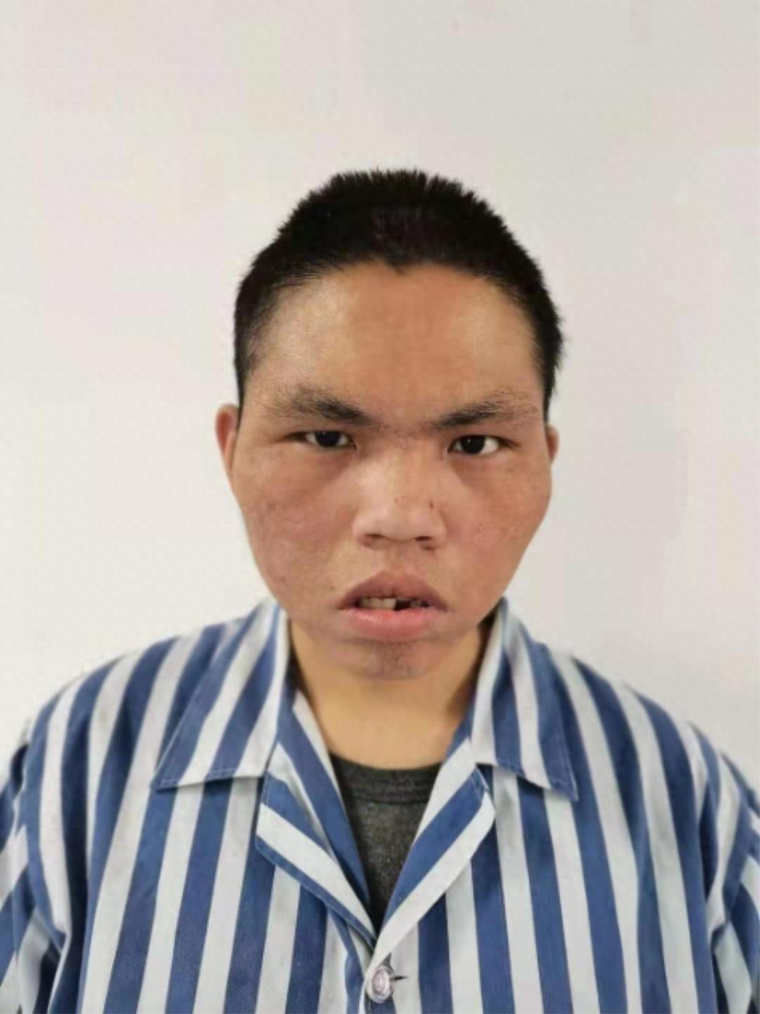 走失者照片 北京市寻亲：青年男子被救助，疑似名...