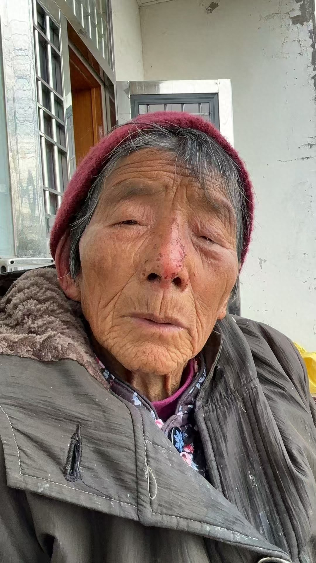 走失者照片 镇江市丹阳市寻人：八旬老太走失，戴...