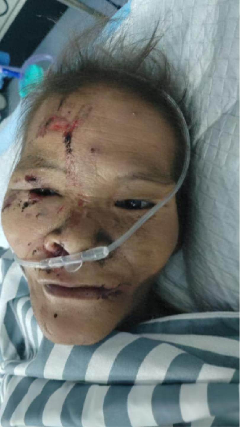 走失者照片 钦州市寻亲：六旬老太被救助，穿黑色...