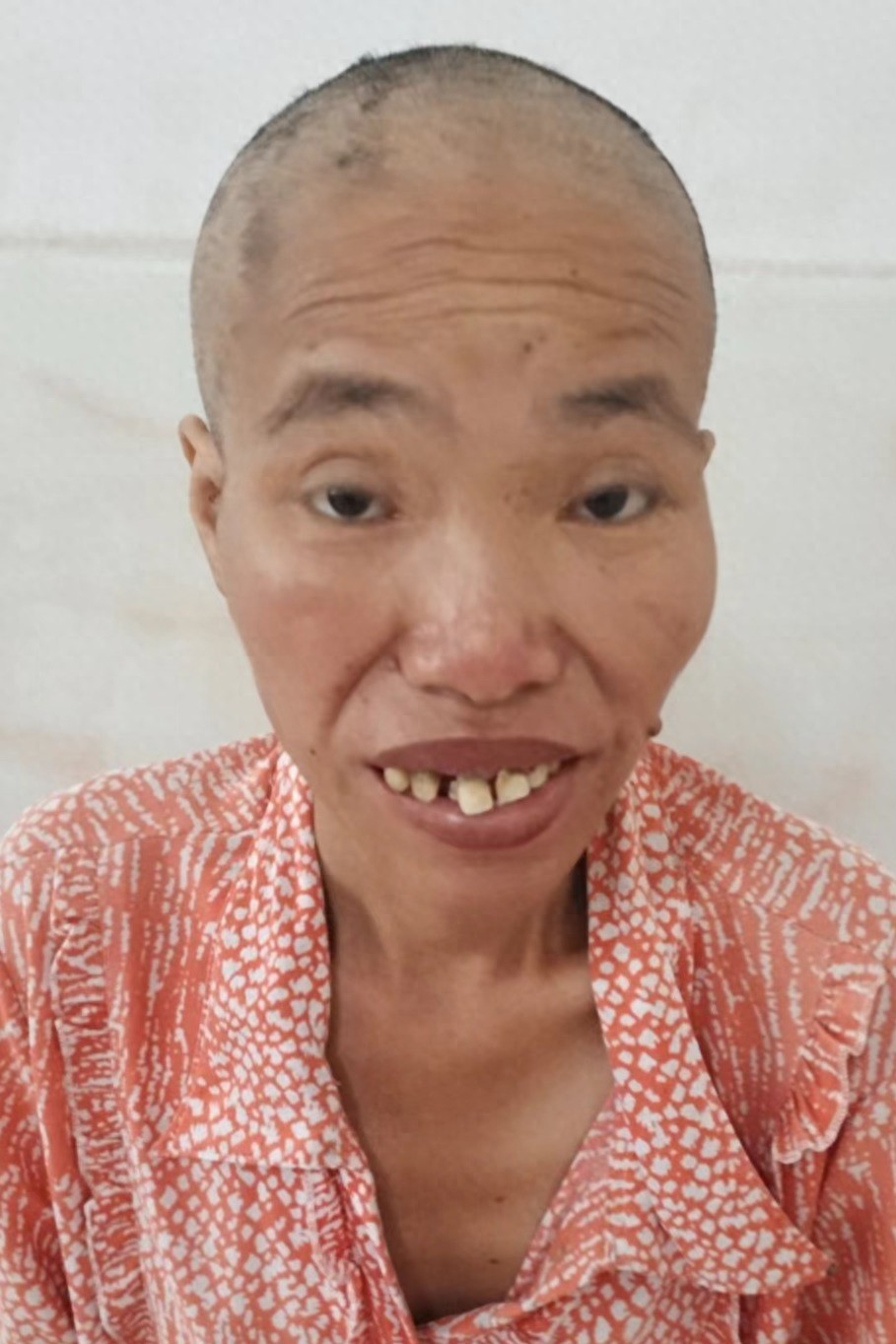 走失者照片 梧州市岑溪市寻亲：五旬女子被救助，...