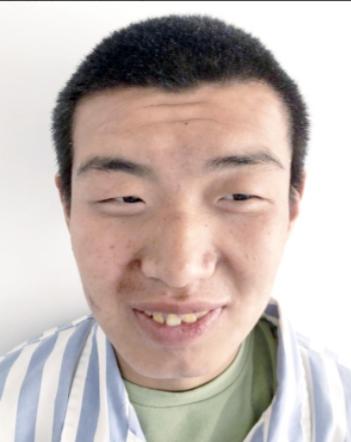 走失者照片 北京市寻亲：青年男子被救助，高1米...