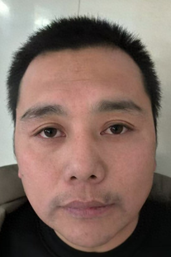 走失者照片 哈尔滨市寻亲：青年男子被救助，自述...