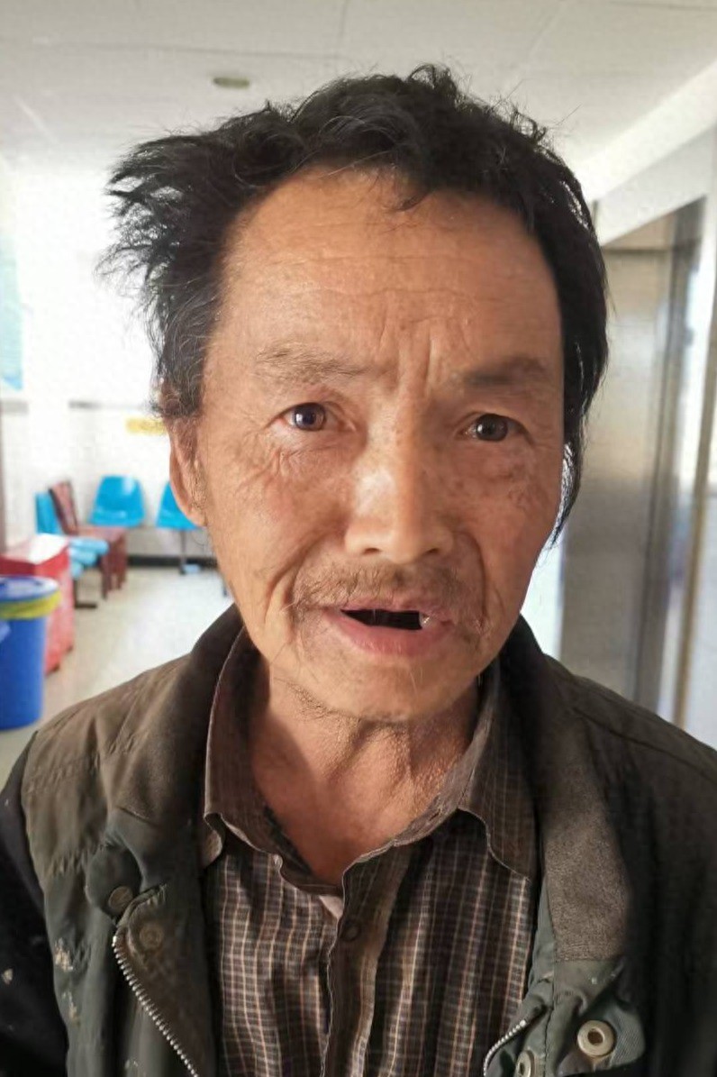 走失者照片 红河州个旧市寻亲：五旬男子被救助，...