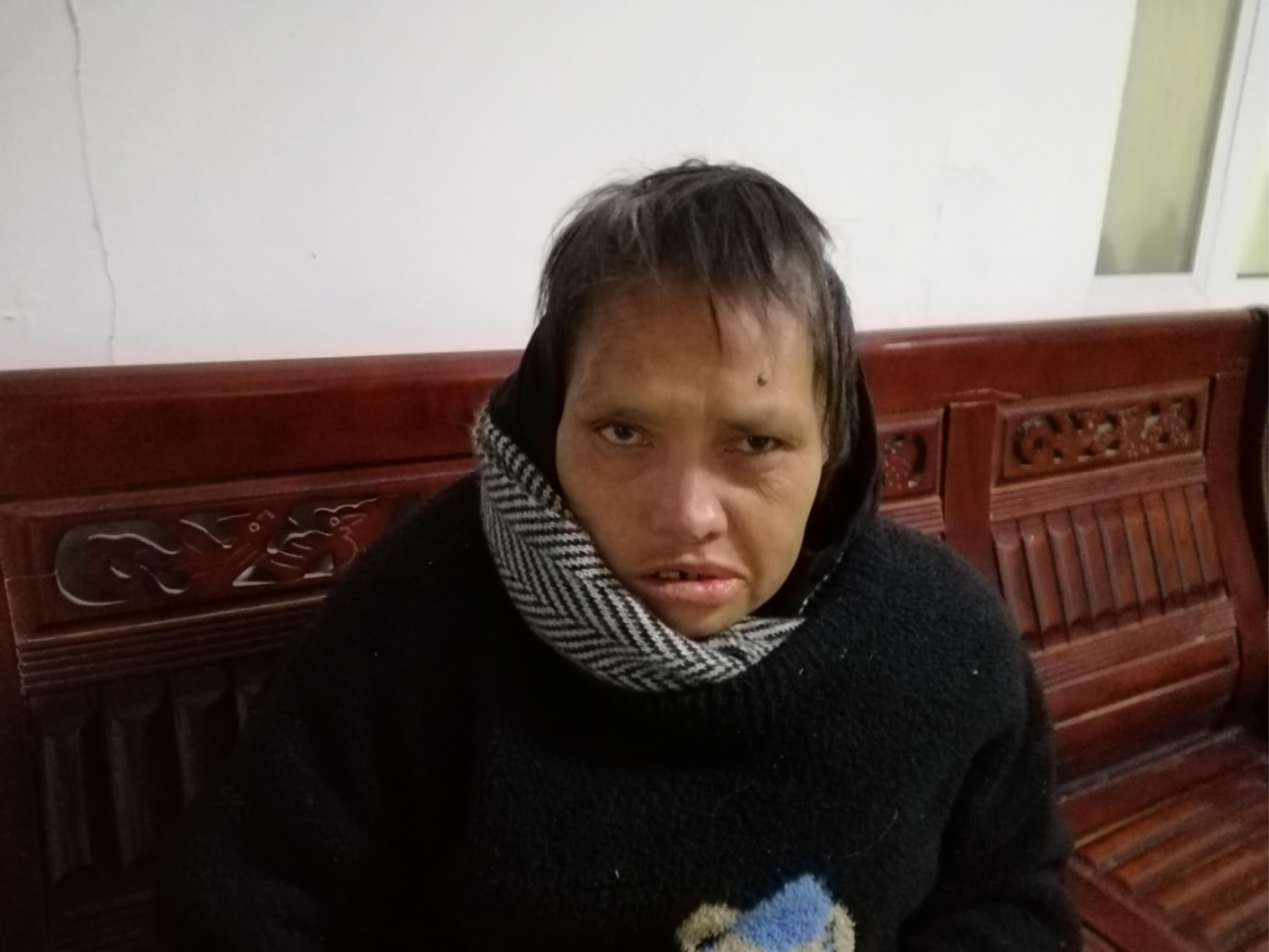 走失者照片 潍坊市寻亲：五旬女子被救助，高1米...