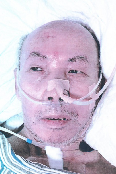 走失者照片 湘西州吉首市寻亲：七旬老人被救助，...