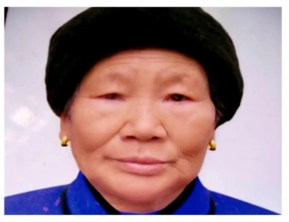 走失者照片 南充市阆中市寻人：八旬老太走失，戴...