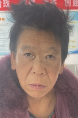 走失者照片 临汾市寻亲：五旬女子被救助，自述叫...