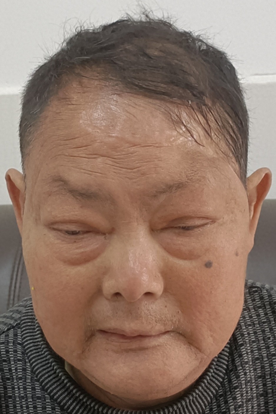 走失者照片 永州市寻亲：六旬老人被救助，穿灰色...