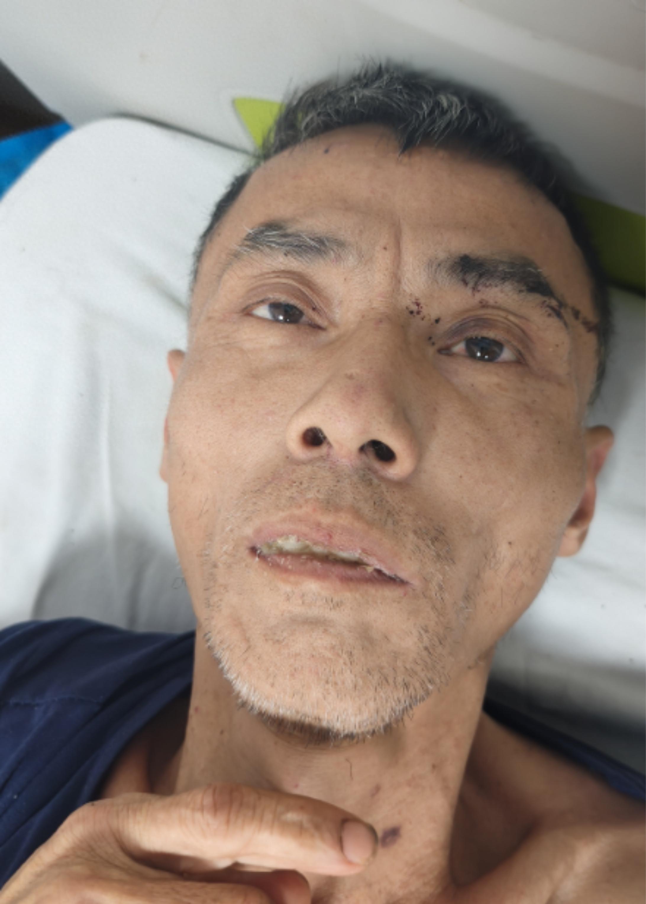 走失者照片 南宁市寻亲：五旬男子被救助，穿黑色...