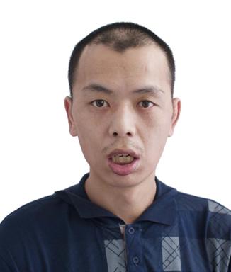 走失者照片 淮安市寻亲：青年男子被救助，疑似智...