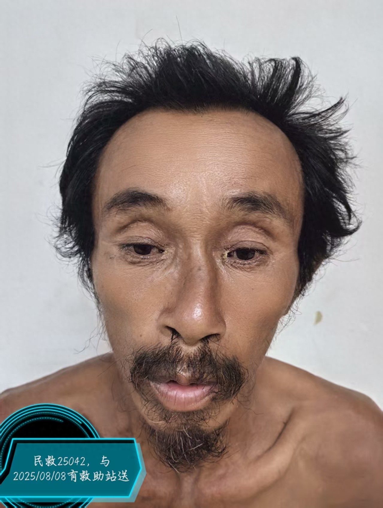 走失者照片 周口市项城市寻亲：六旬老人被救助，...