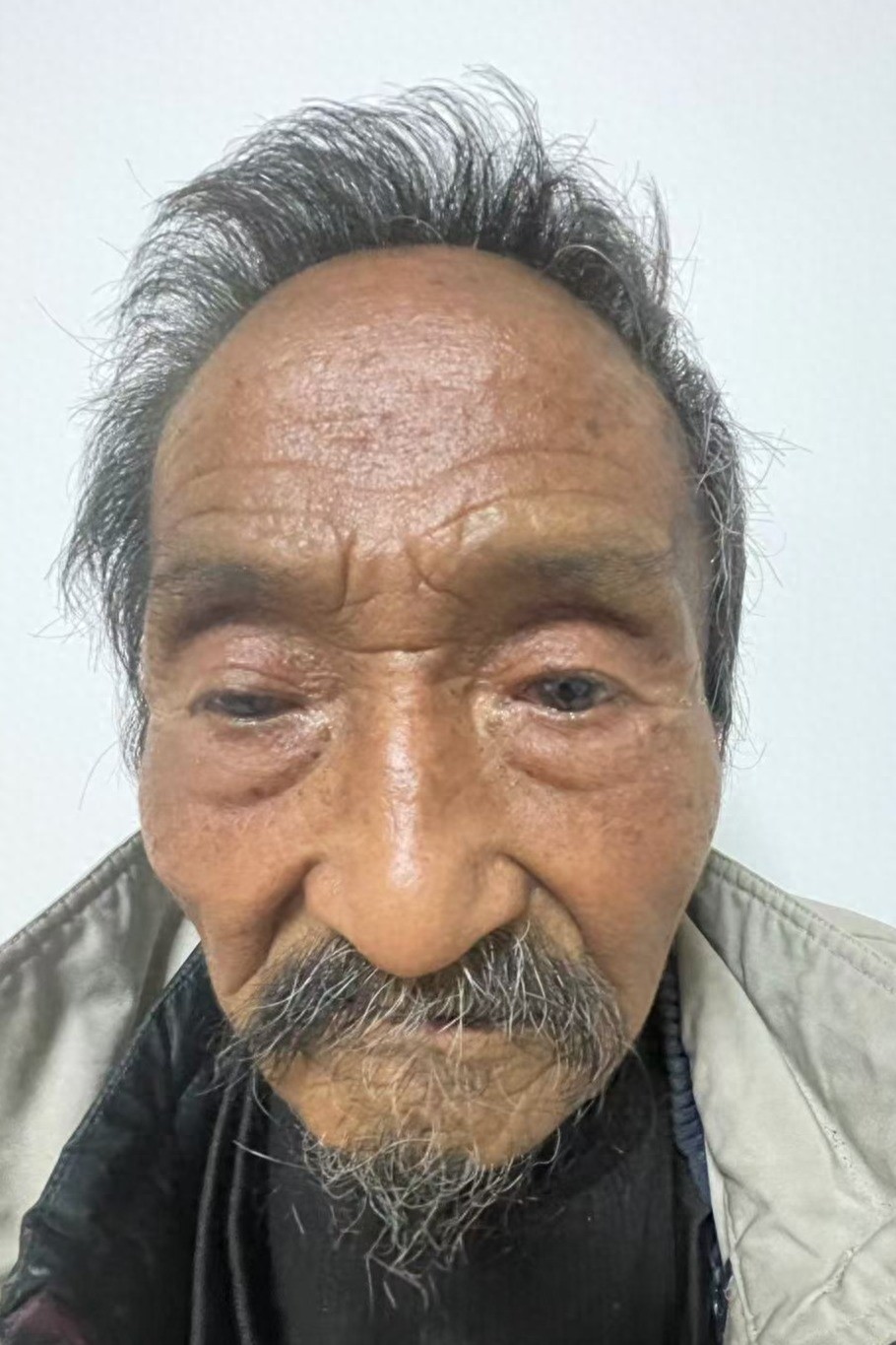 走失者照片 宝鸡市寻亲：七旬老人被救助，自述叫...