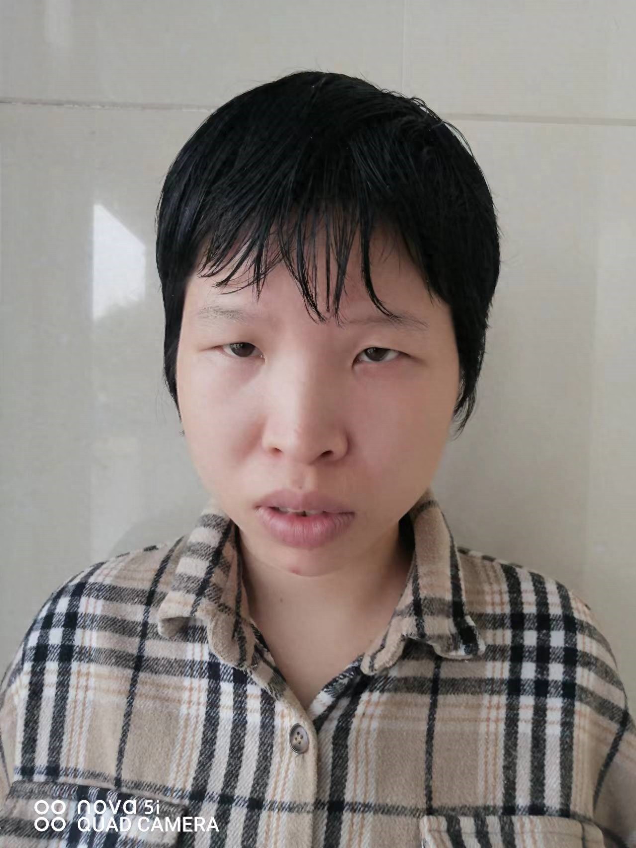走失者照片 抚州市寻亲：青年女子被救助，高1米...