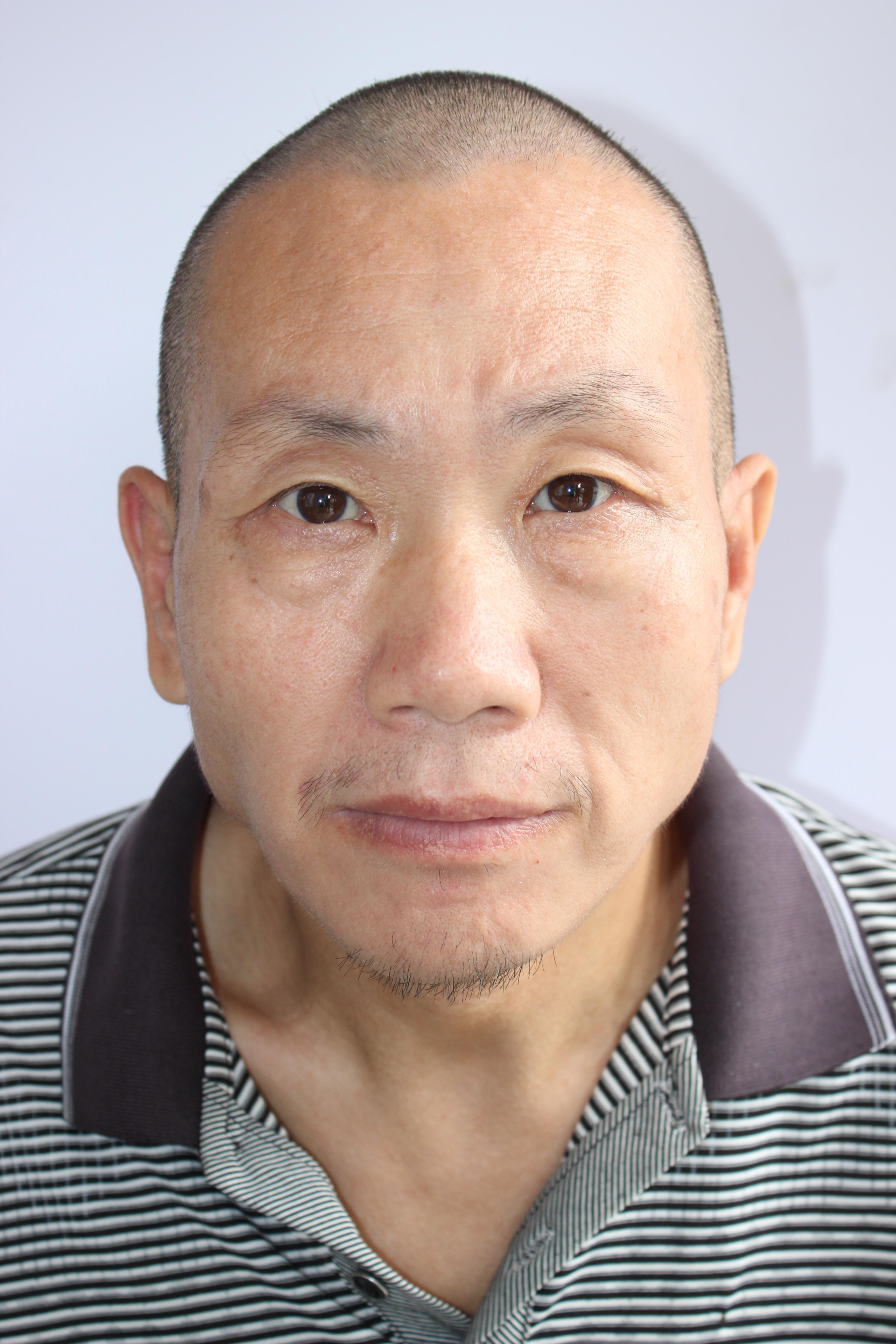 走失者照片 宁波市慈溪市寻亲：五旬男子被救助，...