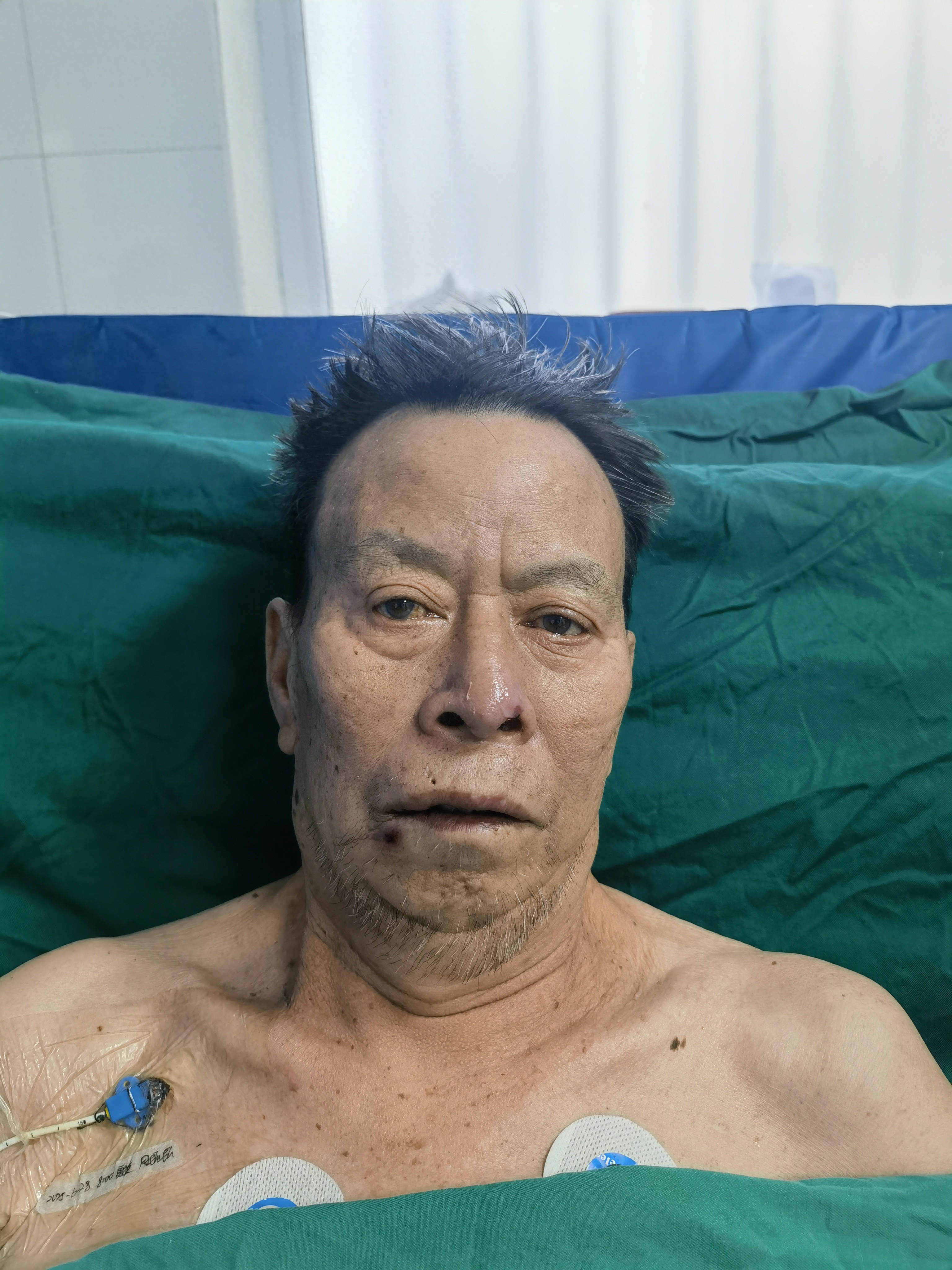 走失者照片 乌鲁木齐市寻亲：七旬老人被救助，自...