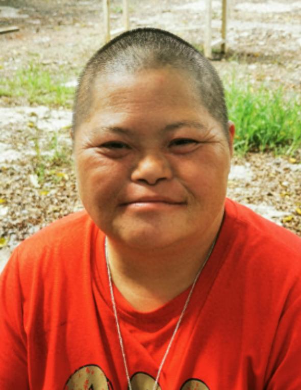 走失者照片 南平市寻亲：中年女子被救助，患唐氏...