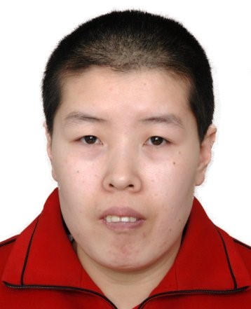 走失者照片 济南市寻亲：青年女子被救助，高1米...