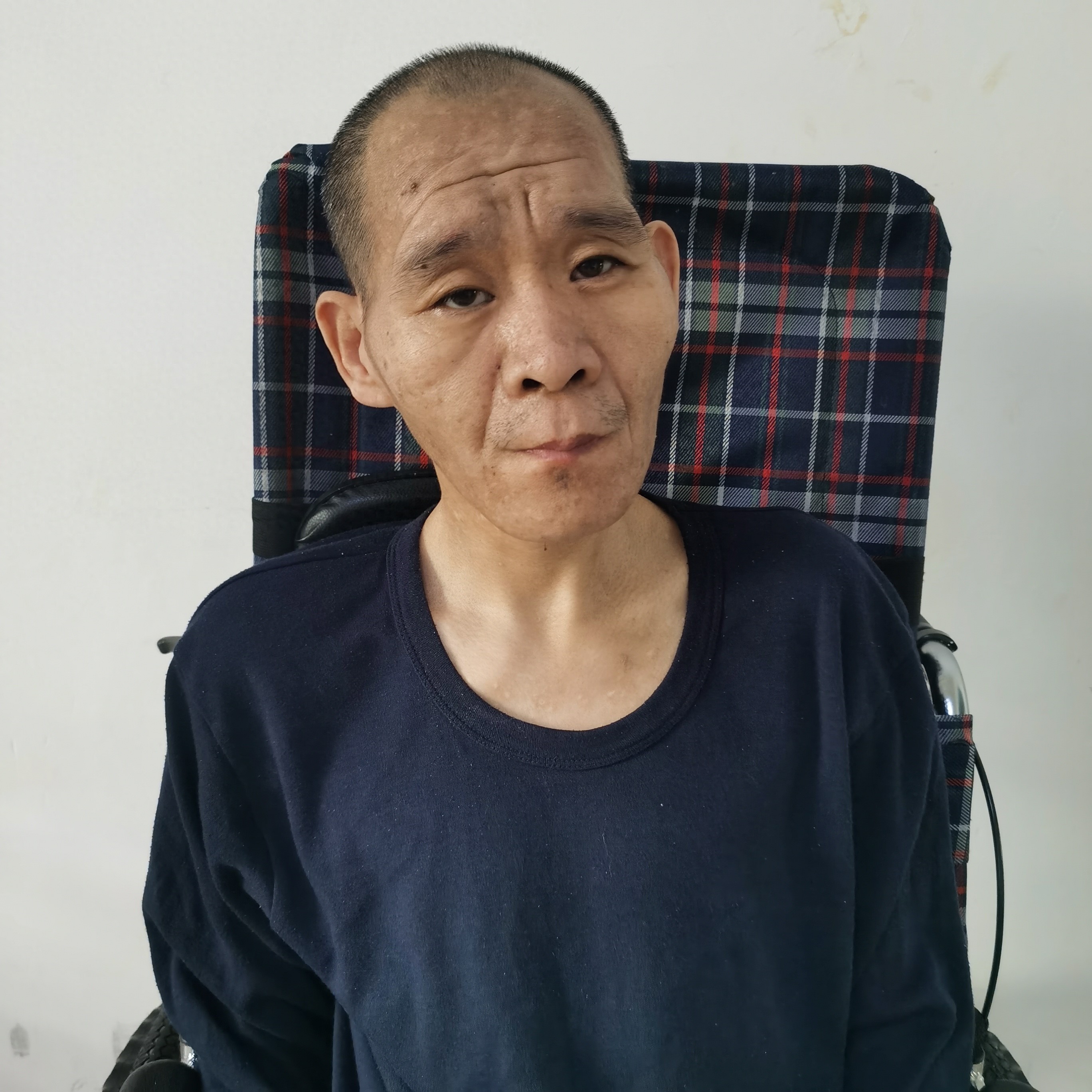 走失者照片 北京市寻亲：中年男子被救助，双脚畸...