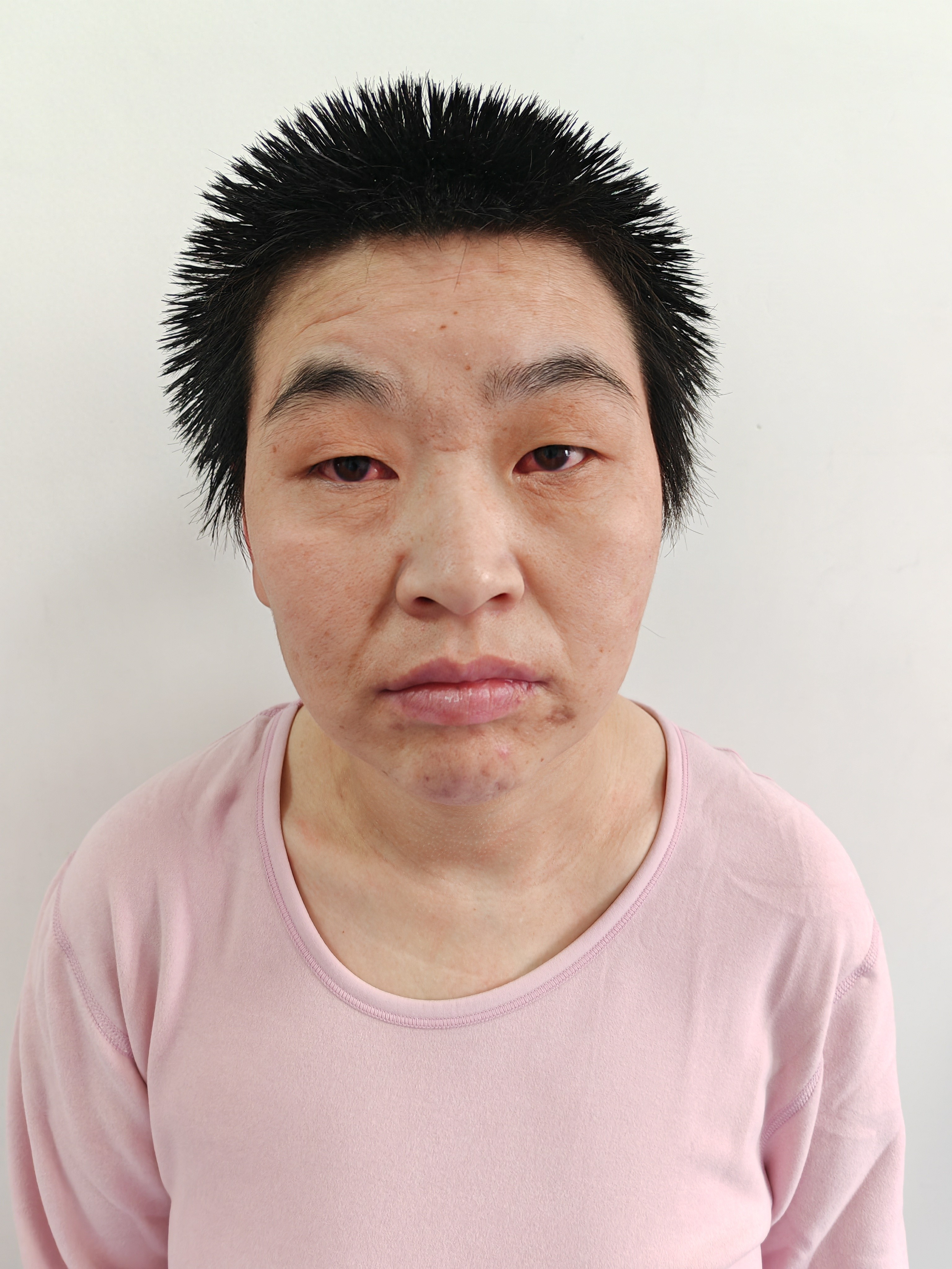 走失者照片 北京市寻亲：中年女子被救助，聋哑人...
