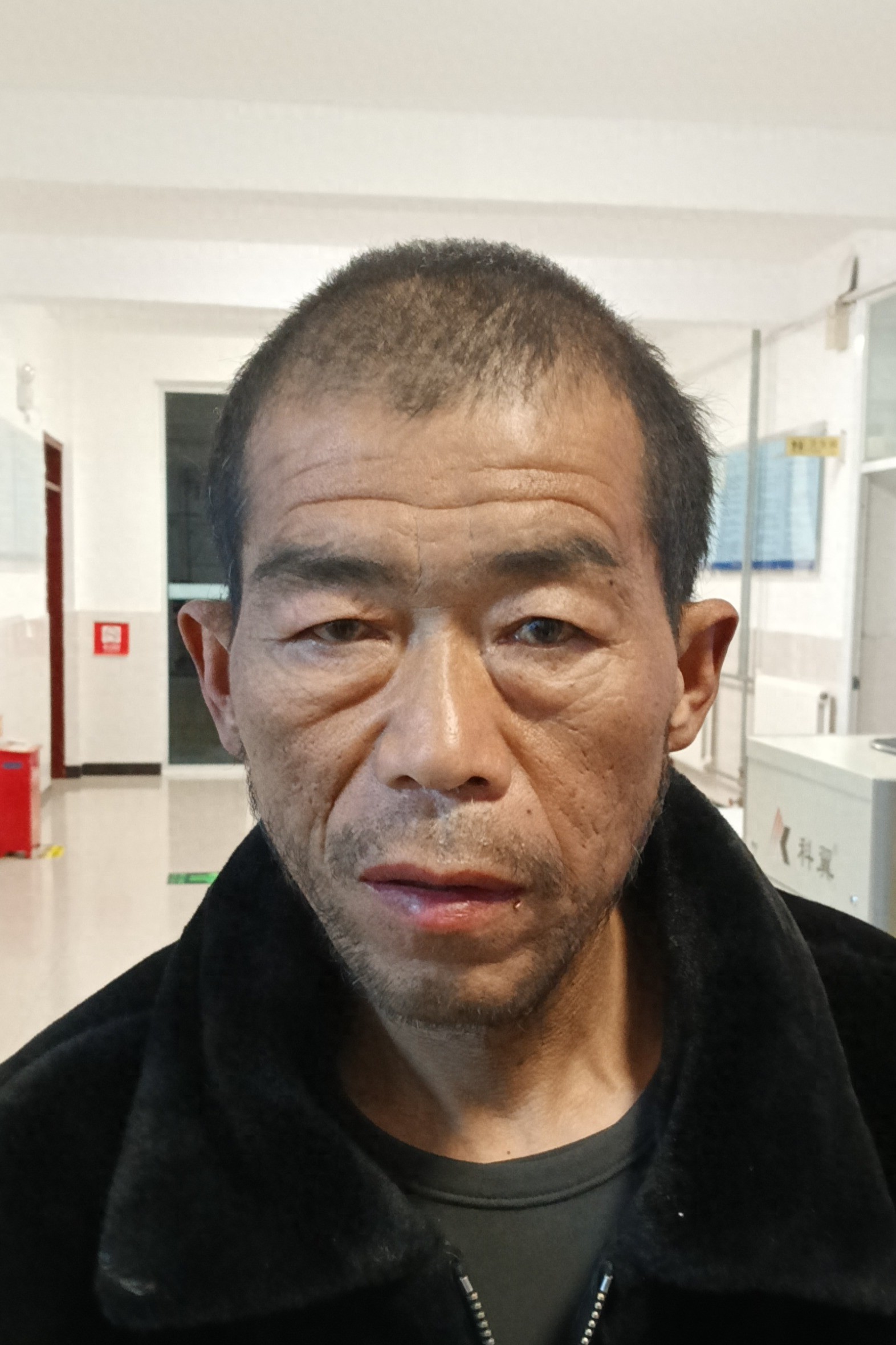 走失者照片 开封市寻亲：五旬男子被救助，自述叫...