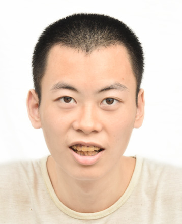 走失者照片 汕头市寻亲：青年男子被救助，高1米...