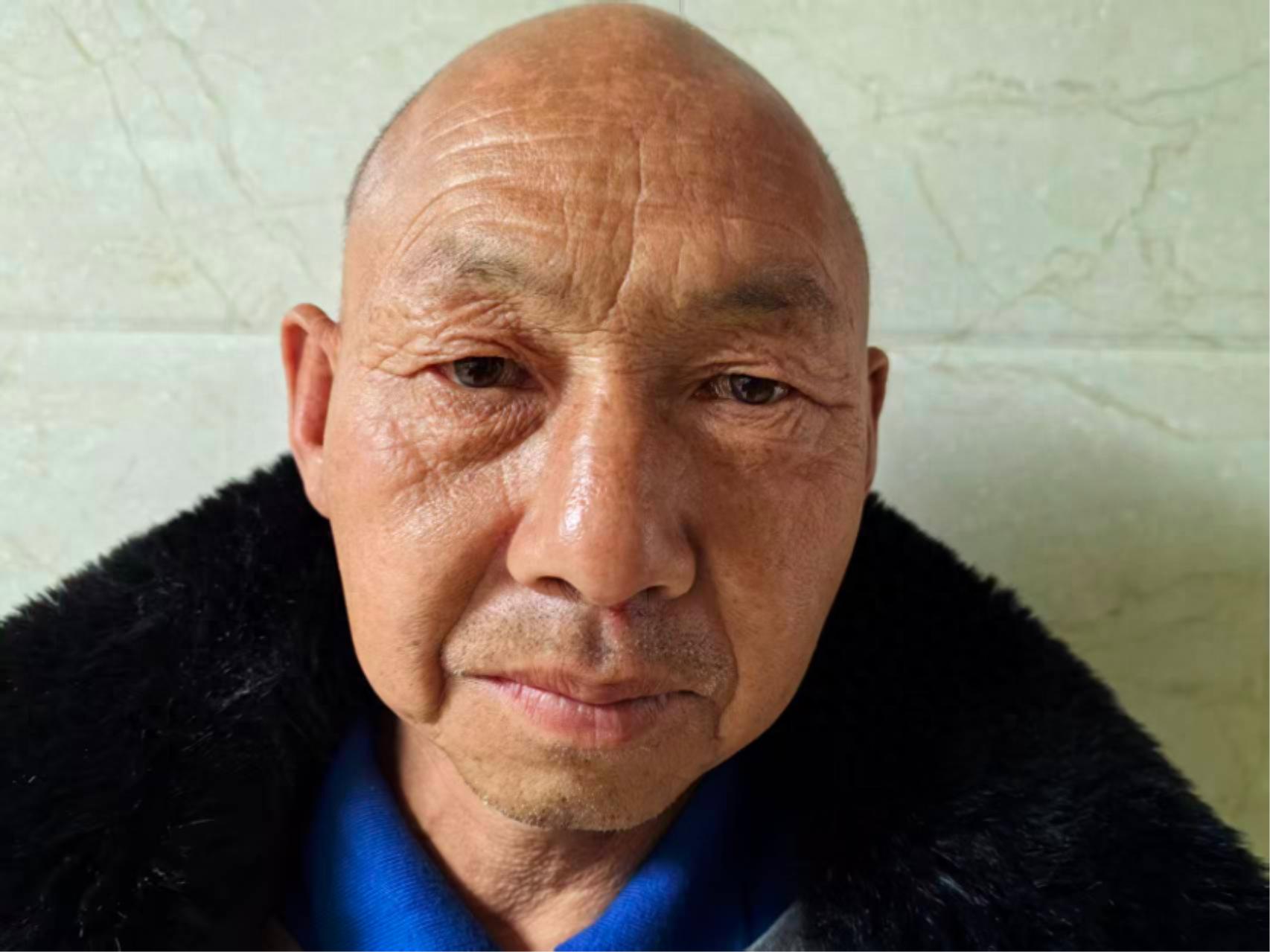 走失者照片 襄阳市寻亲：五旬男子被救助，穿黑色...