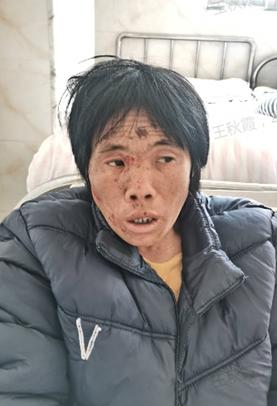 走失者照片 钦州市寻亲：五旬女子被救助，穿黑色...