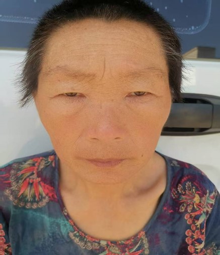 走失者照片 商丘市寻亲：五旬女子被救助，疑似精...