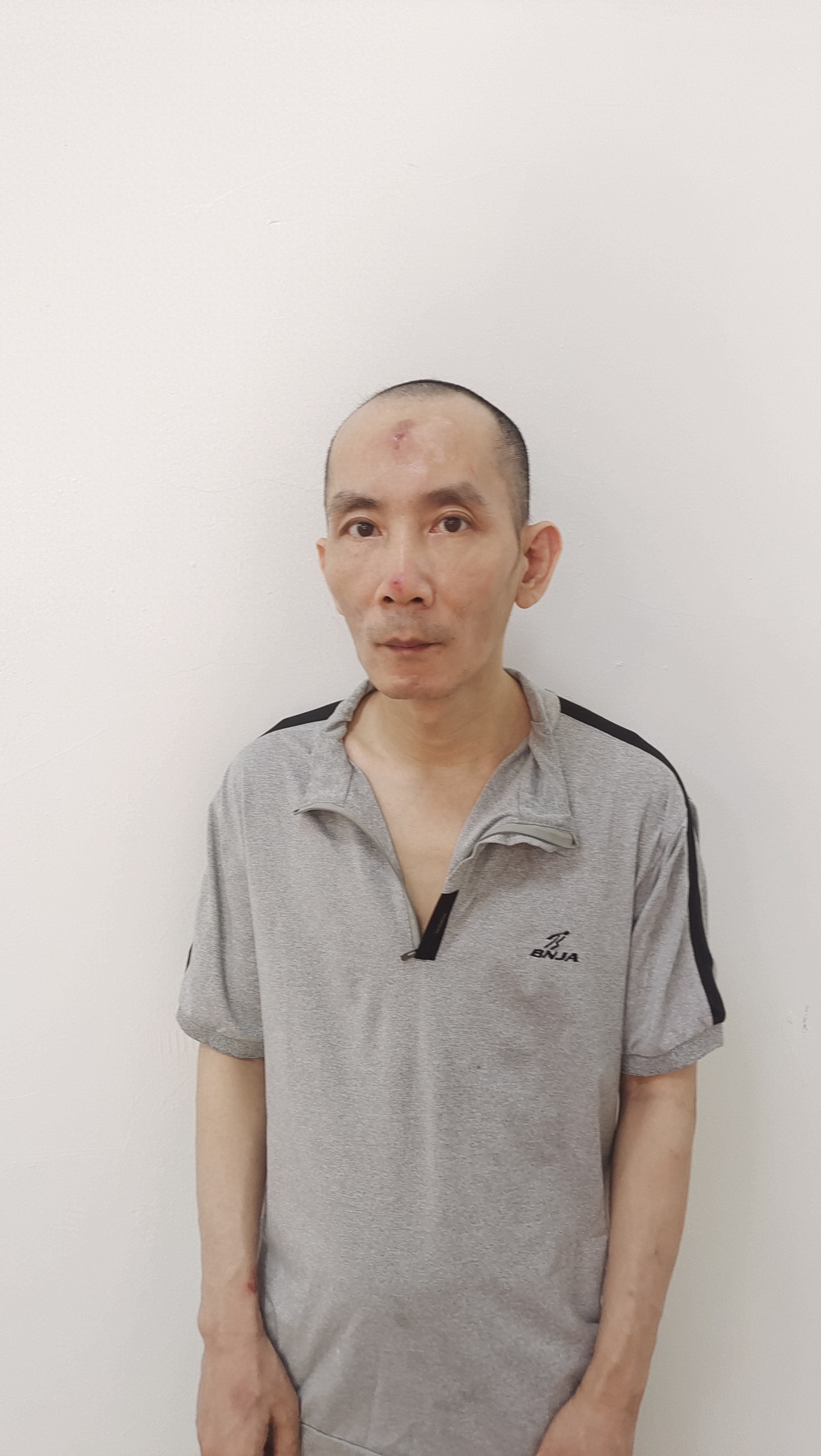 走失者照片 汕尾市陆丰市寻亲：中年男子被救助，...