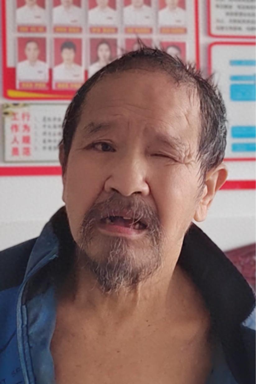 走失者照片 衡阳市寻亲：七旬老人被救助，自述叫...